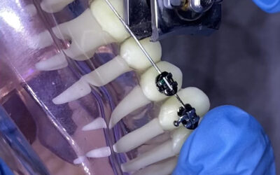 Comment couper un arc qui blesse